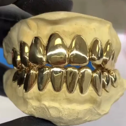 22K Gold Grillz