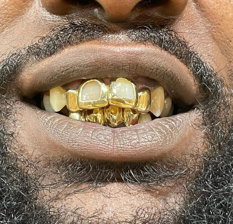 18K Gold Gold Grillz