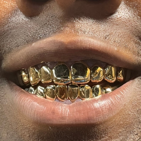 14K Gold Grillz