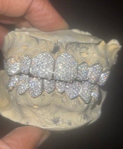 VVS Moissanite Diamond Grillz