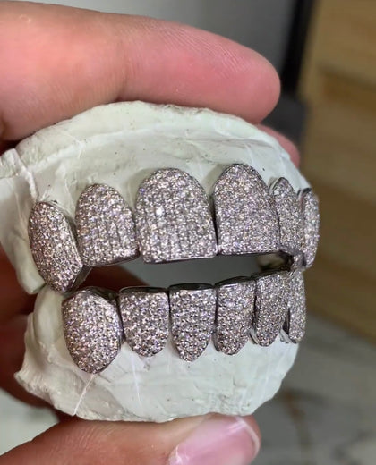 VVS Diamond Grillz