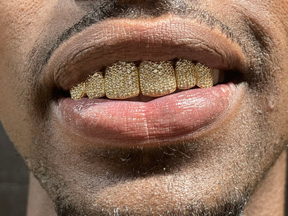 VS Diamond Grillz