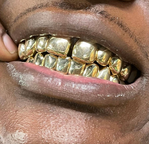 10K Gold Grillz