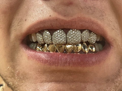 Si Diamond Grillz