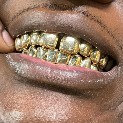 8 Piece Gold Grill 