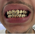 Gold Custom Grill 