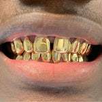 6 Piece 14K Gold Grill 