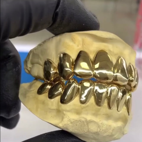 8 Piece 22K Gold Grillz