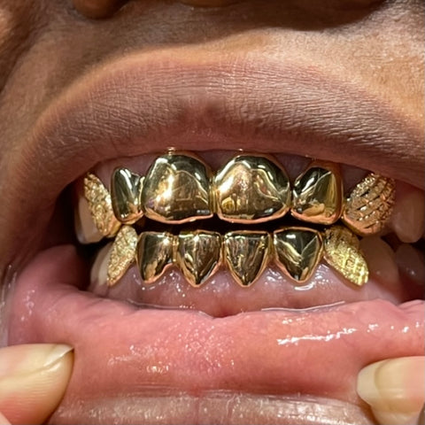 4-Piece Gold Grillz 