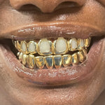 Gold Custom Grill 