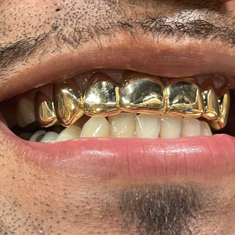 Men's Gold Grill