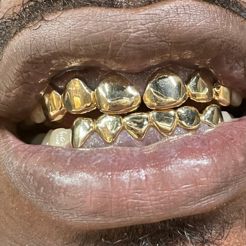 6 Piece Gold Grill 