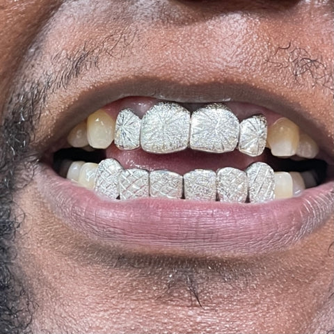 Men's Silver Grillz 