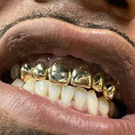 6 Piece Yellow Gold Grill