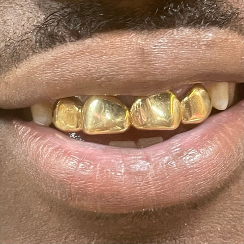 4 Piece 10K Gold Grill