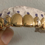 Unique Gold Grill 