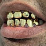 Yellow Gold Grillz