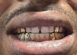 10K Gold Custom Grill