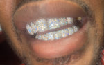 10 on 10 VVS Moissanite Diamond Grillz